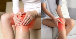 Read more about the article Best Knee Pain Treatment Center in Dhaka