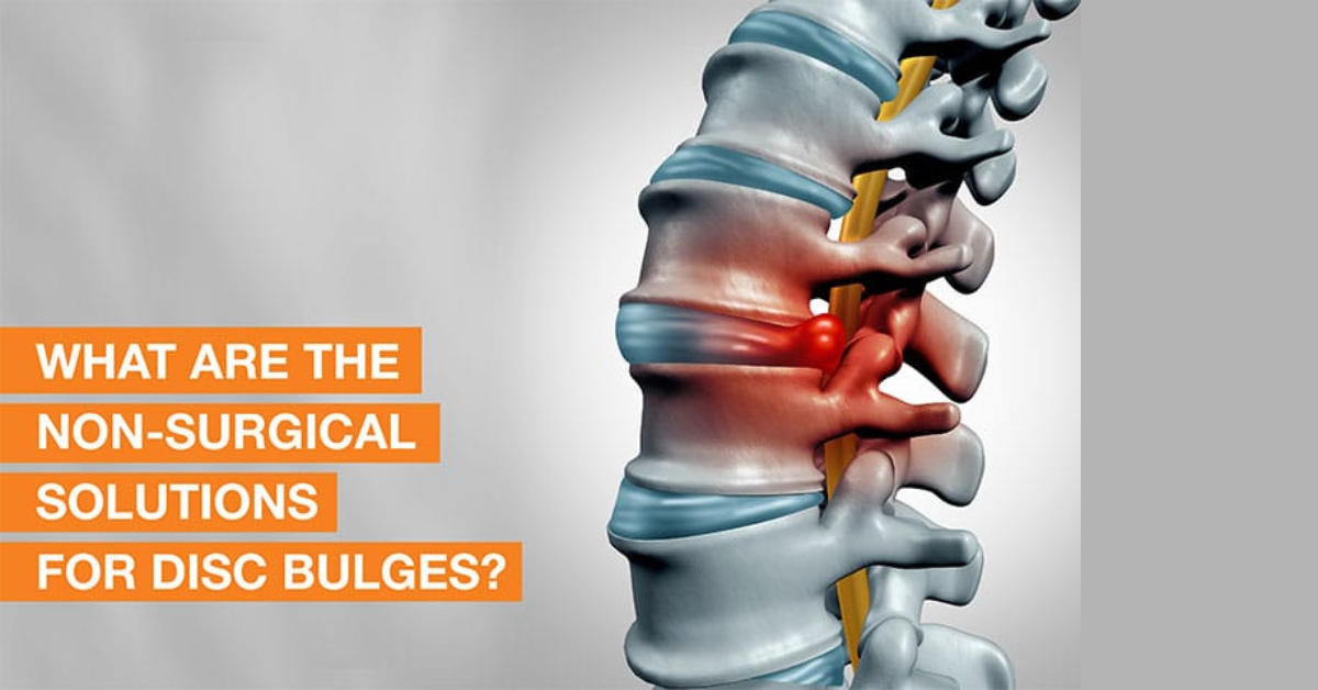 Read more about the article Non-Surgical Slip Disc Treatment in Bangladesh